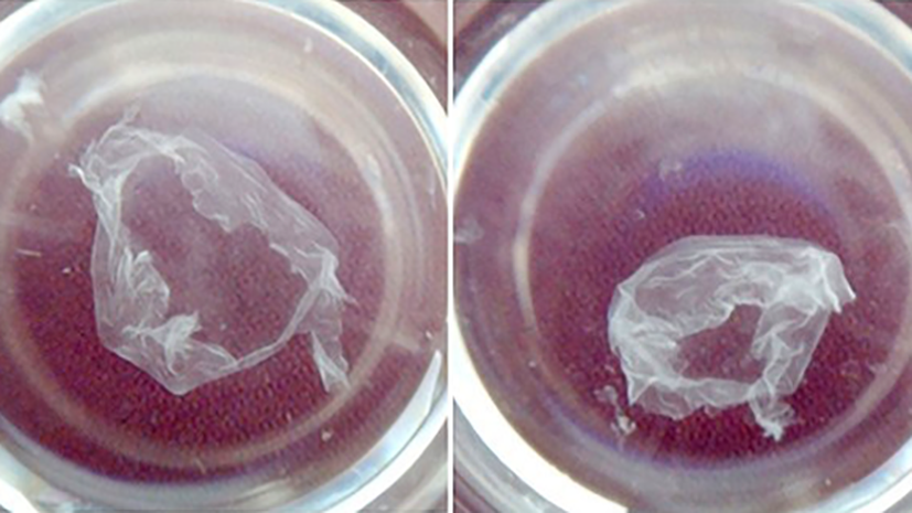 Российские учёные получили биоматериал для восстановления тканей организма - фото 2