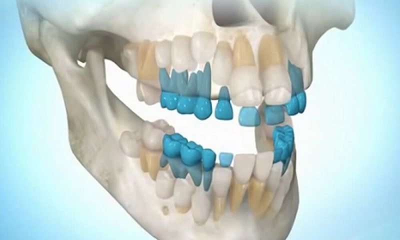  Теперь вырастить зубы станет возможным в любом возрасте - фото 2