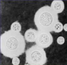 Ученые обнаружили смертельный для больных СПИДом вид грибков - фото 1