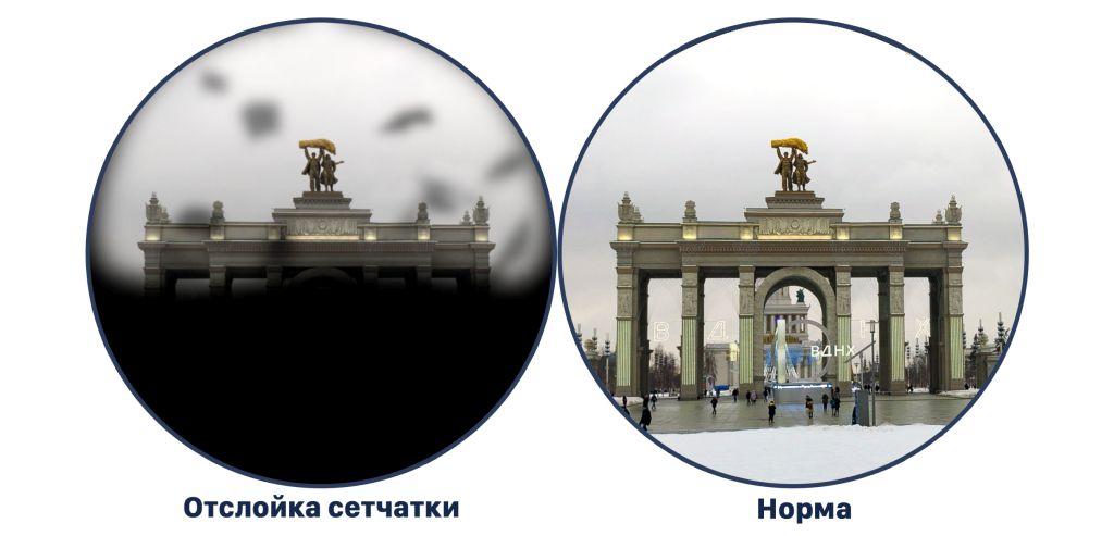 Российские ученые создали первую в мире программу, которая позволяет в реальном времени увидеть мир глазами человека с разными нарушениями зрения    - фото 5