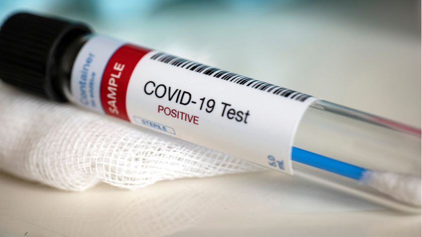 Исследование ученых США: непривитые будут болеть COVID-19 снова и снова каждые 16 месяцев - фото 1