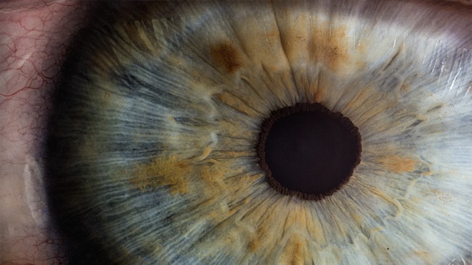 Жидкий протез сетчатки глаза создан учеными - фото 1