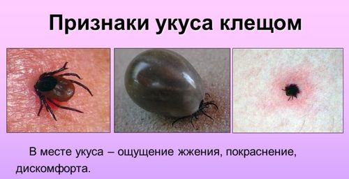 Россию атакуют клещи - фото 1