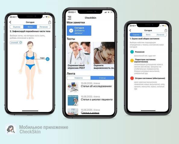 Российские разработчики создали сервис для людей с хроническими заболеваниями кожи - фото 1